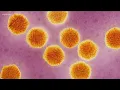 HEP A case confirmed at Local Pizzeria