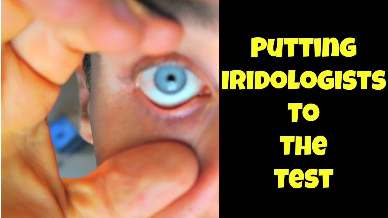 The Blue Eyes Disease Connection of Iridology