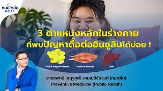  ดื้อต่ออินซูลินเกิดจากอะไรบ้าง และมีตำแหน่งที่สำคัญกี่จุด 