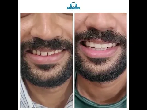 Smile design video testimonial