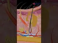 Download Lagu What's inside a pimple? How does acne develop? Medical Arts Animation