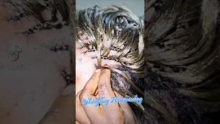 How to do treebraids