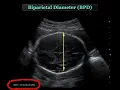 GW Intern US Bootcamp OB Ultrasound Frasure MD