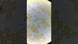 White Blood Cells Fighting Under Microscope 