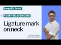 Ligature Mark On Neck Image Ka Sawal Dr Sumit Tellewar Forensic Medicine