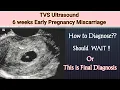 6wks Early Pregnancy Miscarriage Missed Abortion