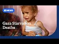 Download Lagu Gaza's doctors warn more children are dying from malnutrition | ABC NEWS