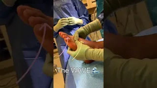 التورم هو العدو   جراحة  كاحل  وذمة  التعافي بعد الجراحة  رعاية ما بعد الجراحة دندنها