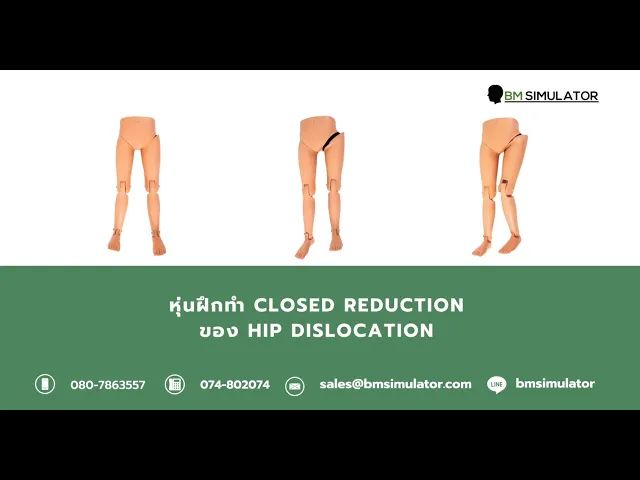 OT008 หุ่นฝึกการทำ Closed  Reduction ของ Hip  Dislocation / Hip   Dislocation  Model