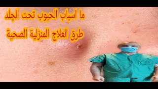 ما اسباب الحبوب تحت الجلد و طرق العلاج المنزلية الصحية دندنها