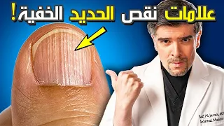    علامات غريبة عندك نقص الحديد و افضل علاج طبيعي  بشهرين    دندنها