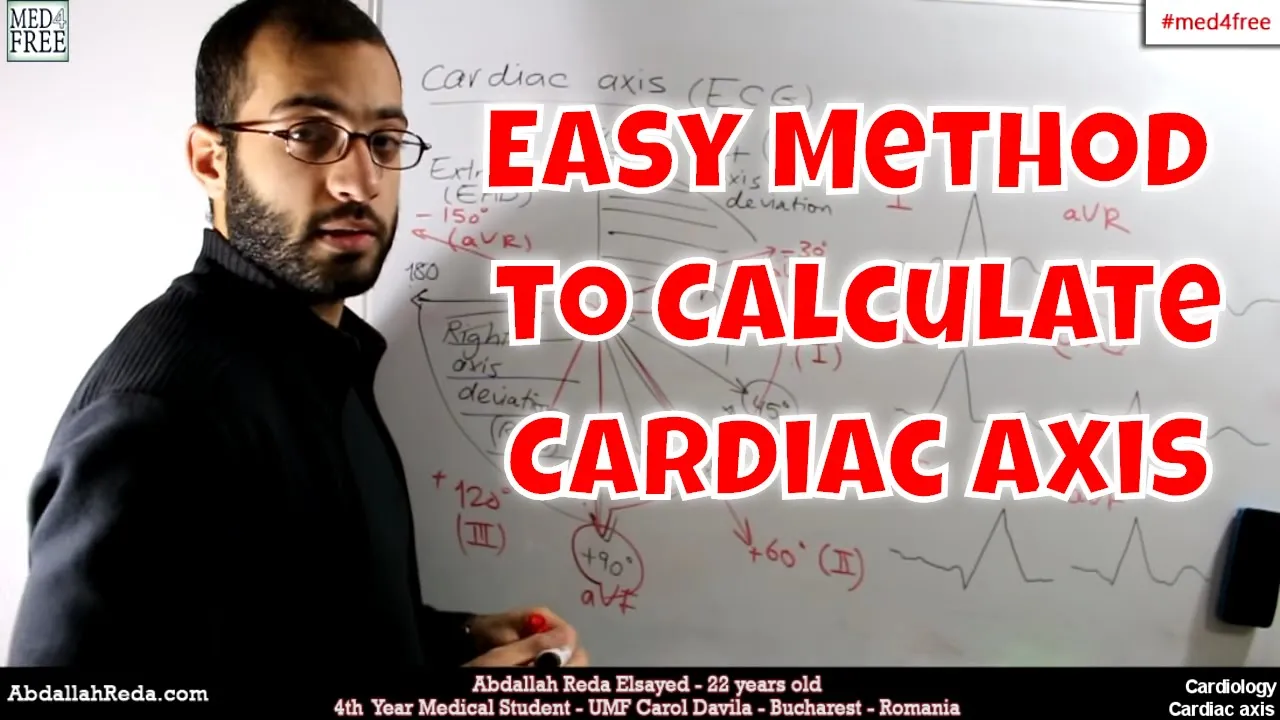 An easy method to calculate the cardiac axis - عبد الله رضا MD | Rocademia روكاديميا