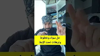 سواد وخطوط وترهلات تحت الإبط؟ د. طلال المحيسن يكشف الأسباب والحل! 😱