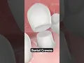 Dental crowns explained 3D animation