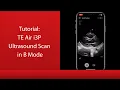 Mindray TE Air Tutorial - Scan in B Mode
