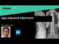 Age-Adjusted Alignment - Han Jo Kim MD