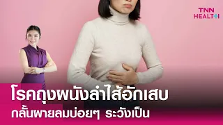  โรคถุงผนังลำไส้อักเสบเกิดจากอะไรบ้าง 