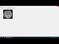 Medical Image Forgery in Matlab