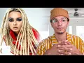 can white people get dreadlocks