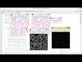 Leukemia Detection Using Matlab Project With Source Code Final Year Project
