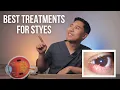 HOW TO GET RID OF STYES FAST 4 Best Stye Eye Treatments EXPLAINED by an MD