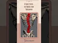 Download Lagu What Does Scoliosis Pain Feel Like and How to Detect Scoliosis at Home? #shorts