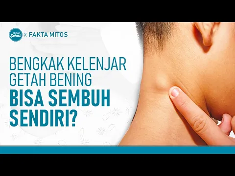 Bengkak Getah Bening Bisa Hilang Dengan Sendirinya, Fakta atau Mitos?