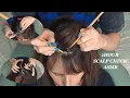 Download Lagu ASMR SCALP CHECK AND DANDRUFF INSPECTION with sticks and tweezers - to talking