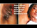 Nair Review-How I Use Nair Hair Removal To Get Rid Of Ingrown Hairs And Razor Bumps
