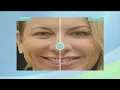 Natural Looking Results at The Med Spa at Eye-Q