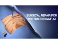 Pectus Excavatum Surgical Repair A Cincinnati Children s Medical Animation