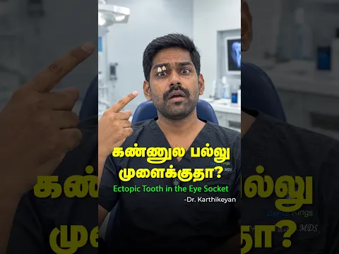 கண்ணுல பல்லு முளைக்குதா? - Ectopic tooth in the eyelid | Dr. Karthikeyan | Denta Kings