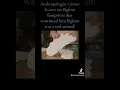 Anthropologist Grover Krantz on Bigfoot footprints that convinced him Bigfoot was a real animal