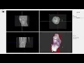 Qt PyQt Python VTK MPR Volume VR