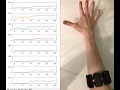 Capturing of EMG data after filtration