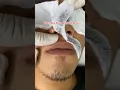 Download Lagu pilih waxing kumis apa cukur manual #cukur #waxingkumis #wax
