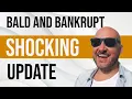 Biography Lifestyle Net Worth of Bald and Bankrupt