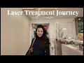 Painless laser hair removal at Bared Monkey Laser