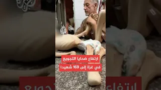 مدير مجمع الشفاء الطبي ارتفاع عدد ضحايا التجويع في قطاع غزة إلى 169 بينهم 93 طفلا 