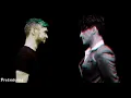 Lose My Mind (Acoustic) - Dean Lewis (S L O W E D)