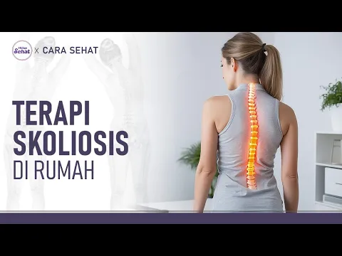 Terapi Sederhana di Rumah untuk Memperbaiki Postur Skoliosis