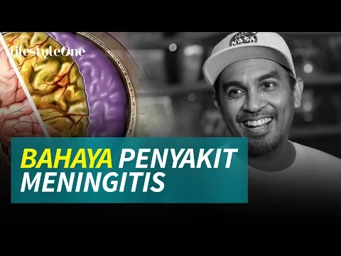 Kenali Bahaya Meningitis! Penyebab Glenn Fredly Meninggal Dunia | lifestyleOne