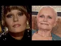 Superman Star Valerie Perrine Gets New Teeth After Suffering From Parkinson s