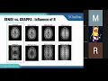 Parallel Imaging