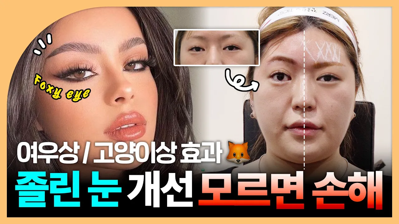 수술없는 눈썹거상 실리프팅｜폭시아이, 캣아이 만드는 방법 🦊😺