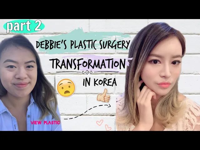 LIFE CHANGING PLASTIC SURGERY REVIEW_KOREA (PART 2)
