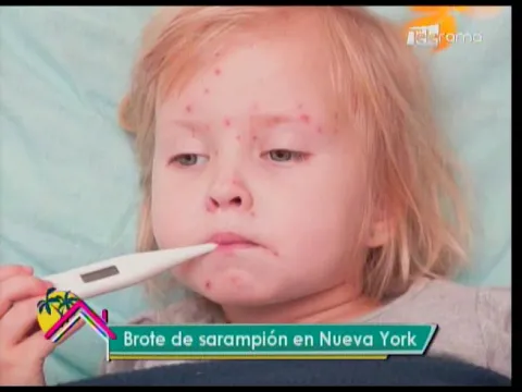 Brote de sarampión en Nueva York
