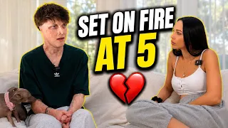 Set on fire at age 5 by His Own Father | Full Interview