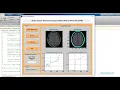Brain Tumor Detection and Classification using Artificial Neural Network MATLAB code