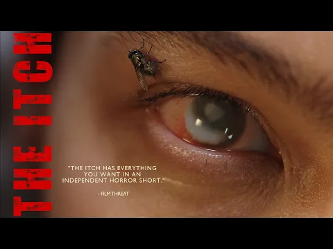 The Itch Trailer 1